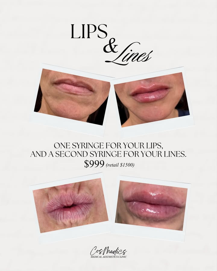 Lips & Lines